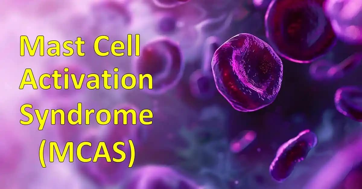 Mast Hücre Aktivasyon Sendromu İçin VOC ve Partikül Filtreli Hava Temizleyici Seçimi Rehberi